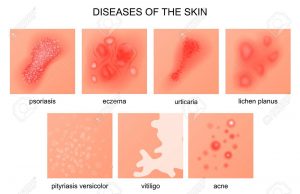 Curation of skin disease